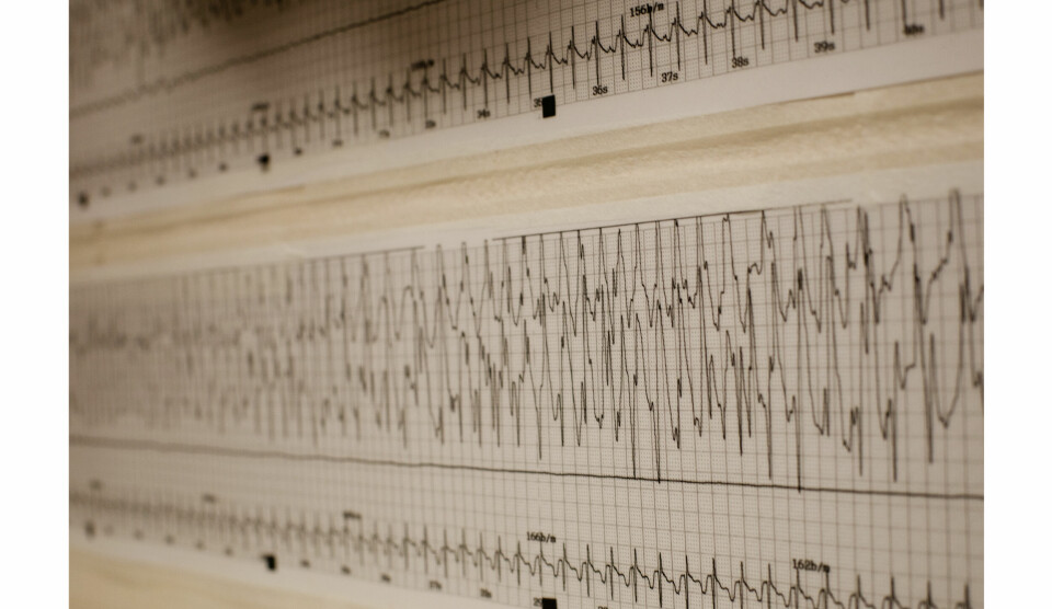 Grafene viser hvordan elektrisiteten strømmer gjennom hjernen til en pasient på psykiatrisk klinikk ved Stavanger Universitetssjukehus. Foto: Annemor Larsen / VG / NTB Scanpix