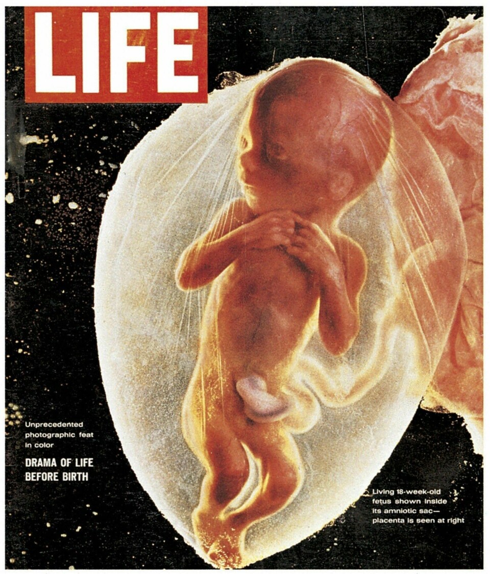 I 1965 trykket Life Magazine ett av Lennart Nilssons fosterbilder på coveret. Det ble utsolgt på bare noen dager.«Drama of life before birth» var tittelen, men i realiteten var det et bilde av et foster abortert i 18. svangerskapsuke.